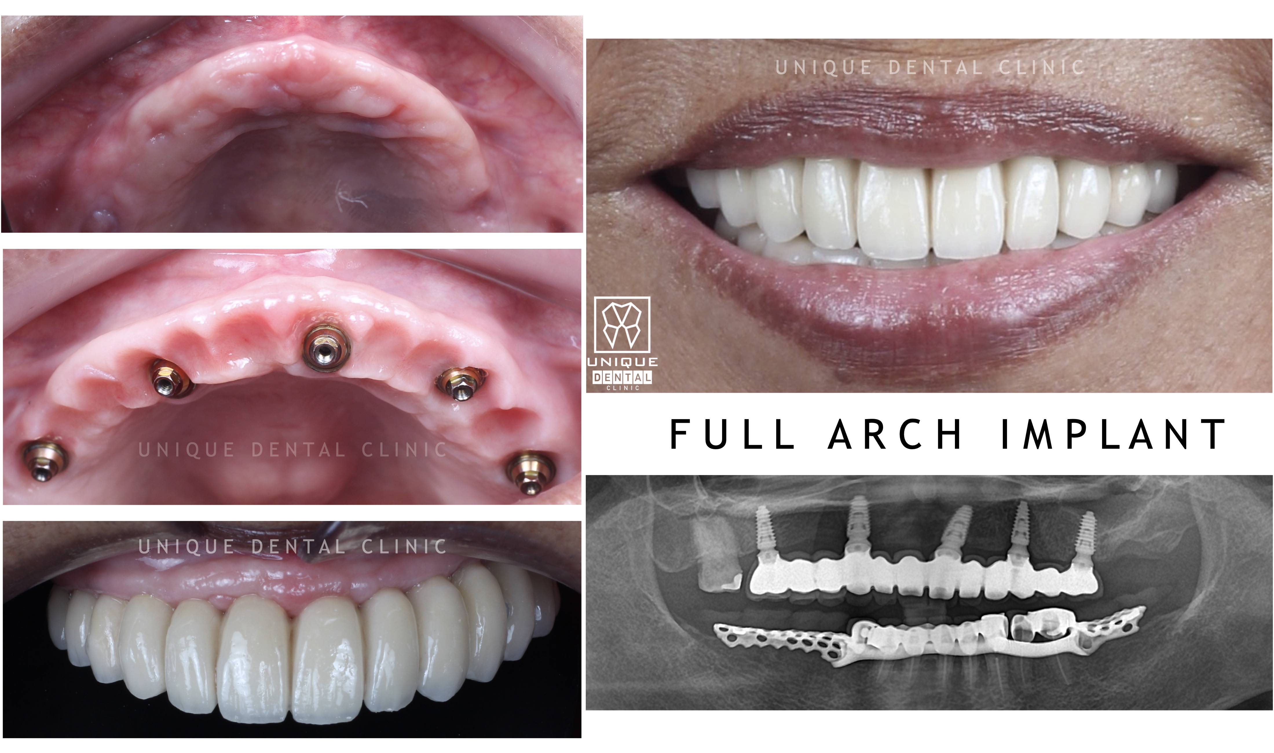 case image